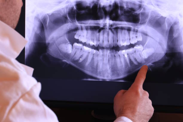 Best Broken or Cracked Tooth Emergency Dentist in Geronimo, OK