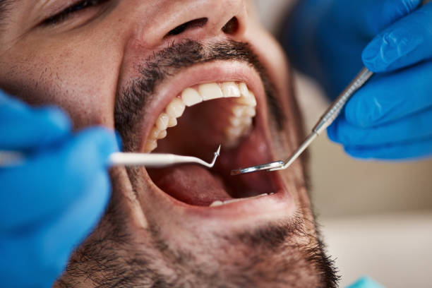 Best Urgent Dental Care for Toothache in Geronimo, OK